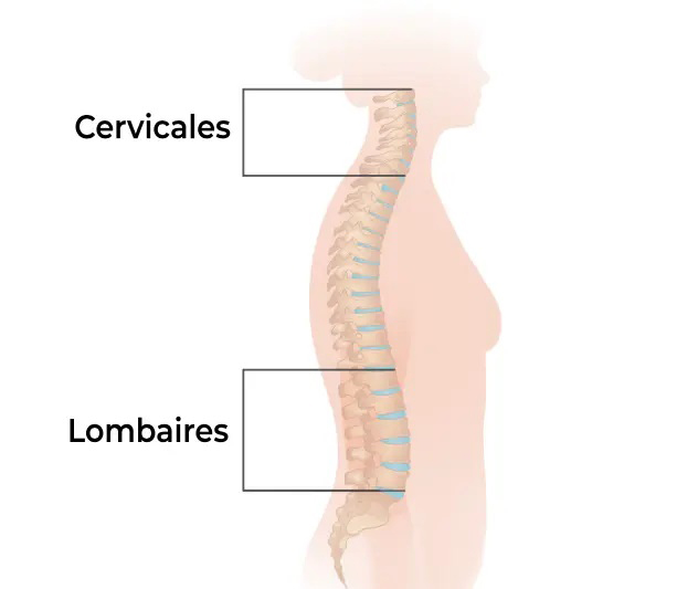 hernies discales cervicale lombaire schema